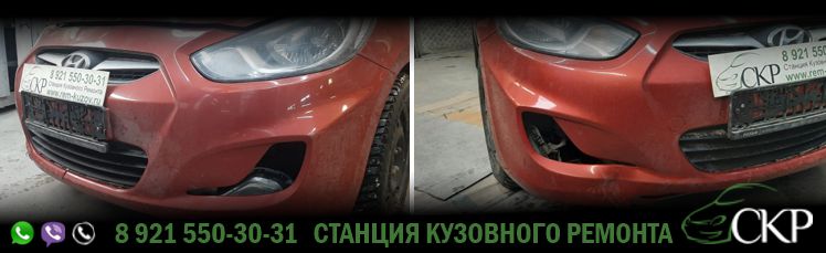 Замена переднего бампера на Хендай Солярис (Hyundai Solaris) в СПб в автосервисе СКР